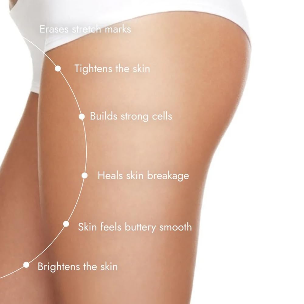 Cos-IQ Stretch Marks Removal Roll-On Serum with Striover | Scar Removal | Uneven Skin Tone | All Skin Types | 40ml