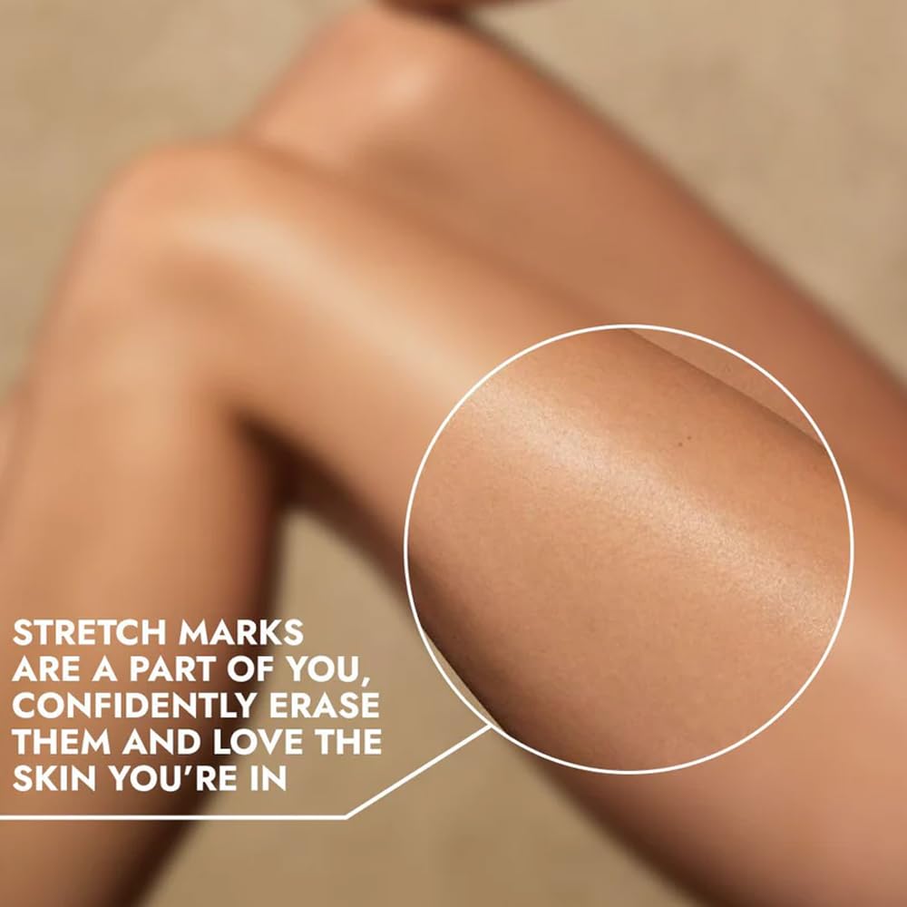 Cos-IQ Stretch Marks Removal Roll-On Serum with Striover | Scar Removal | Uneven Skin Tone | All Skin Types | 40ml