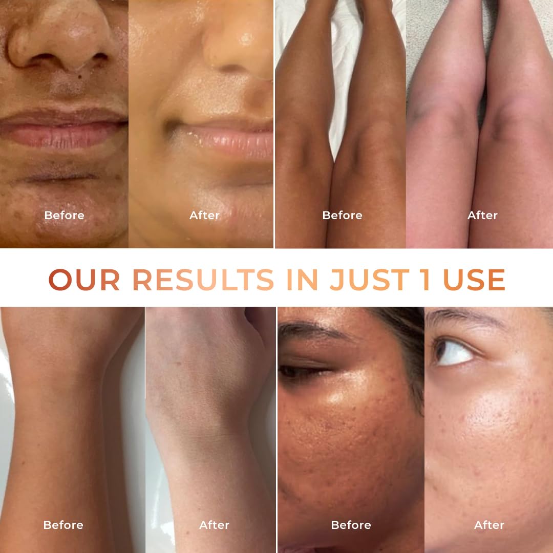 NICONI Tan Vanish Gluta-Kojic Skin Polish | Instant Tan Removal & Glow | Infused with Kojic Acid & Glutathione | Ideal for All Skin Types | Lightens Suntan | 180g