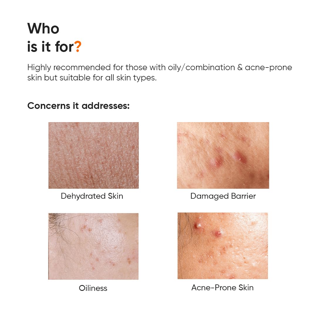 Minimalist Dehydrated Skin Moisturizer with 10% Vitamin B5 for Oily & Acne-Prone Skin | Oil-Free Hydration & Lightweight Gel Formula for Damaged Barrier Repair | Fast-Absorbing & Non-Sticky Lightweight Winter Cream | 50 grams
