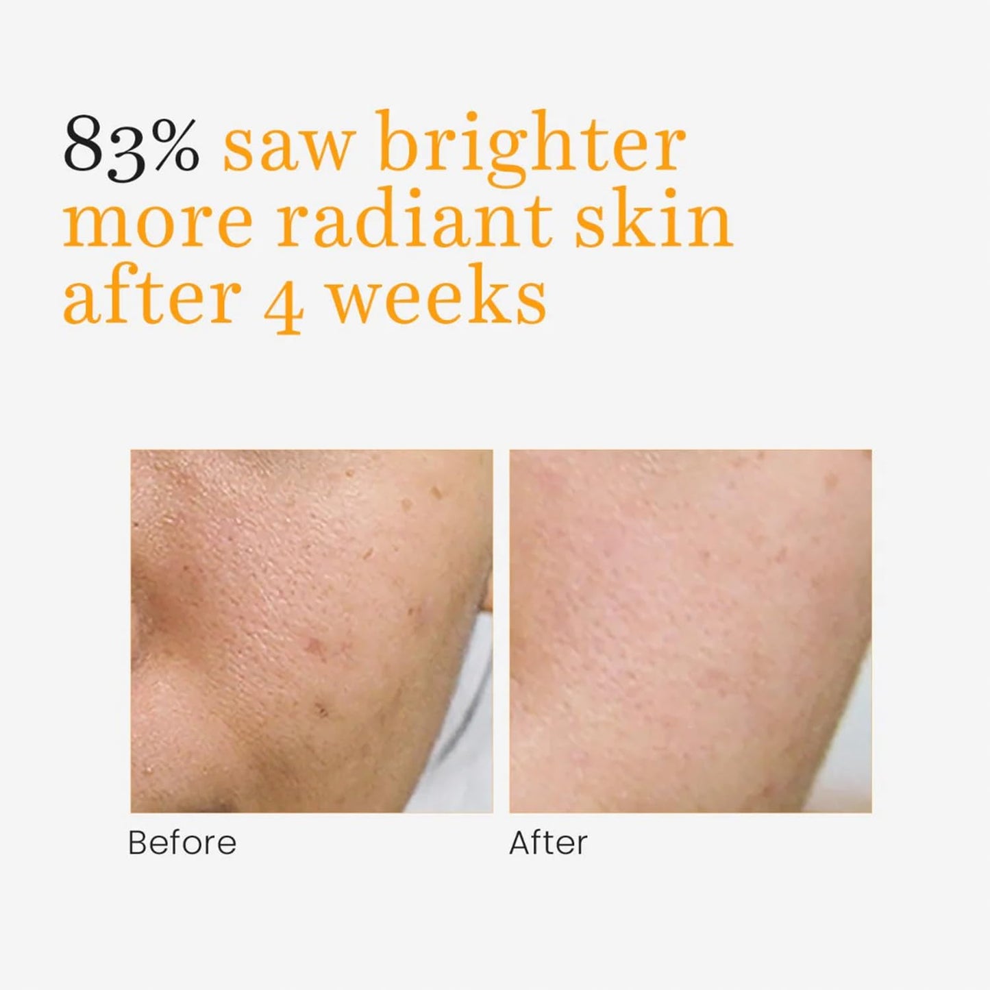 O3+ Vitamin C Face Serum Glow 30ml for Radiant Glowing Skin | Suitable for Combination Skin