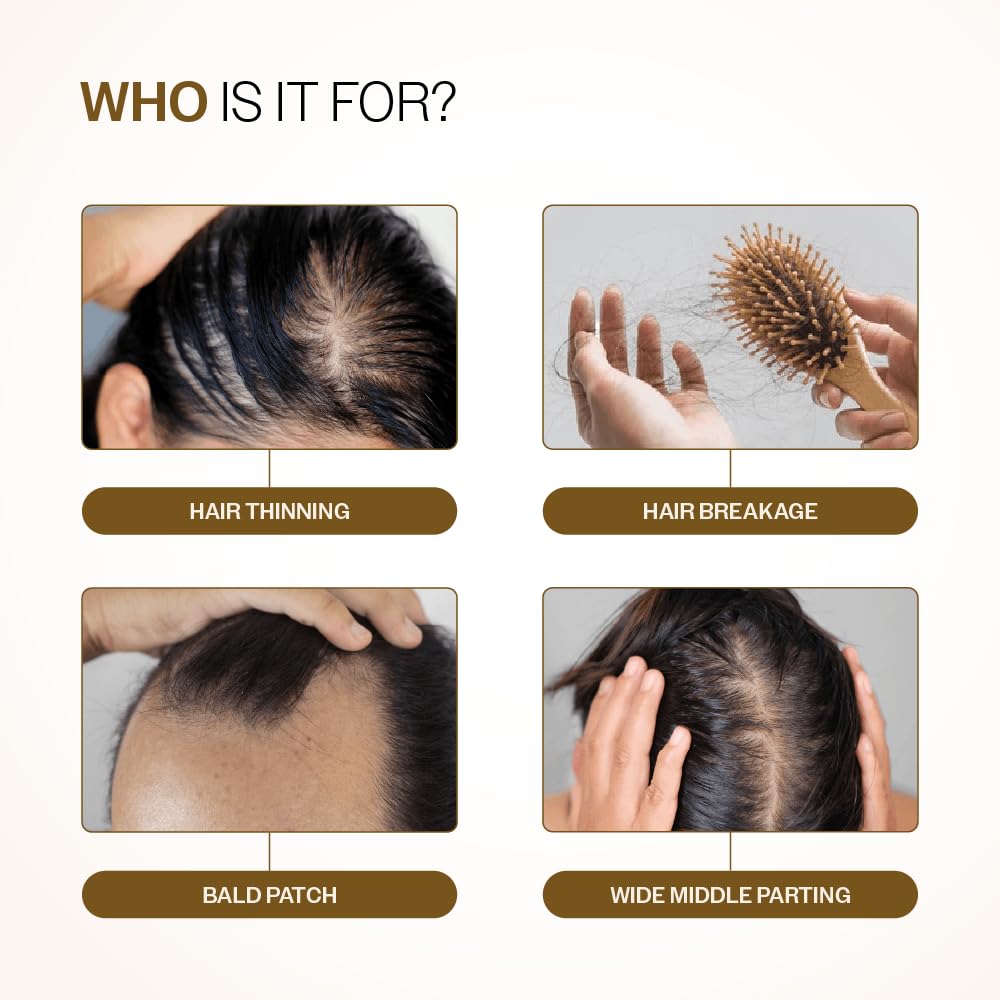 Bare Anatomy Advanced Hair Growth Serum | 3% Redensyl, 4% Anagain, 3% Baicapil, 1% Capilia Longa, Rosemary, Biotin & Rice Water | Controls Hair Fall & Supports Hair Density | for Women & Men | 30ml