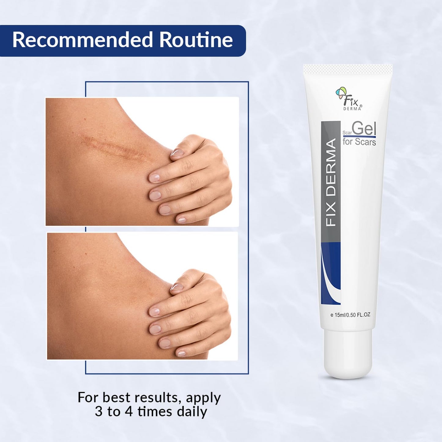 Fixderma Scar gel, Reduces Acne Scars, Surgery Scars, Injury Scars, Burn Scars, Keloid Scars, Scar Diminishing Gel, Scars due to Stretch marks, Suitable for all skin types- 15g