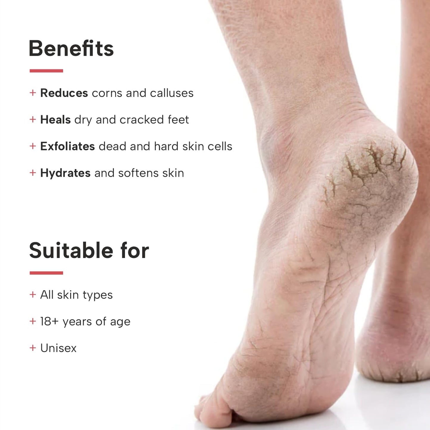 DERMATOUCH Xero Cream | Specially for Dry & Cracked Feet | Soothes & Moisturizes |For Corns & Calluses| For both Men & Women | 50G
