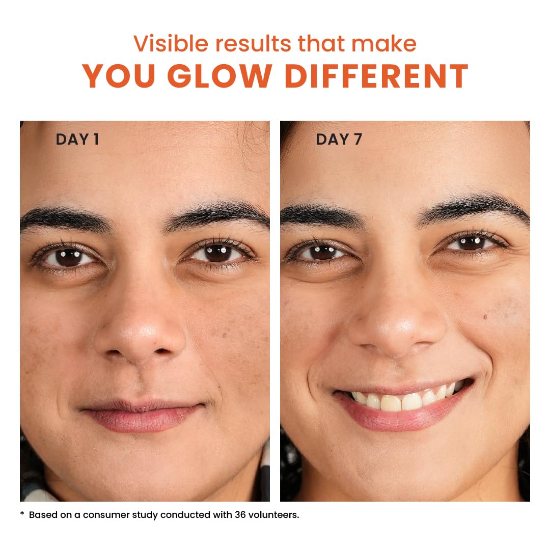 Foxtale 10% Vitamin C + Glutathione Complex Serum, Brightens skin in 3 days, Fades melasma & dark spots, Evens Skin tone, Gentle & Non-irritating, For All Skin types, Men & Women