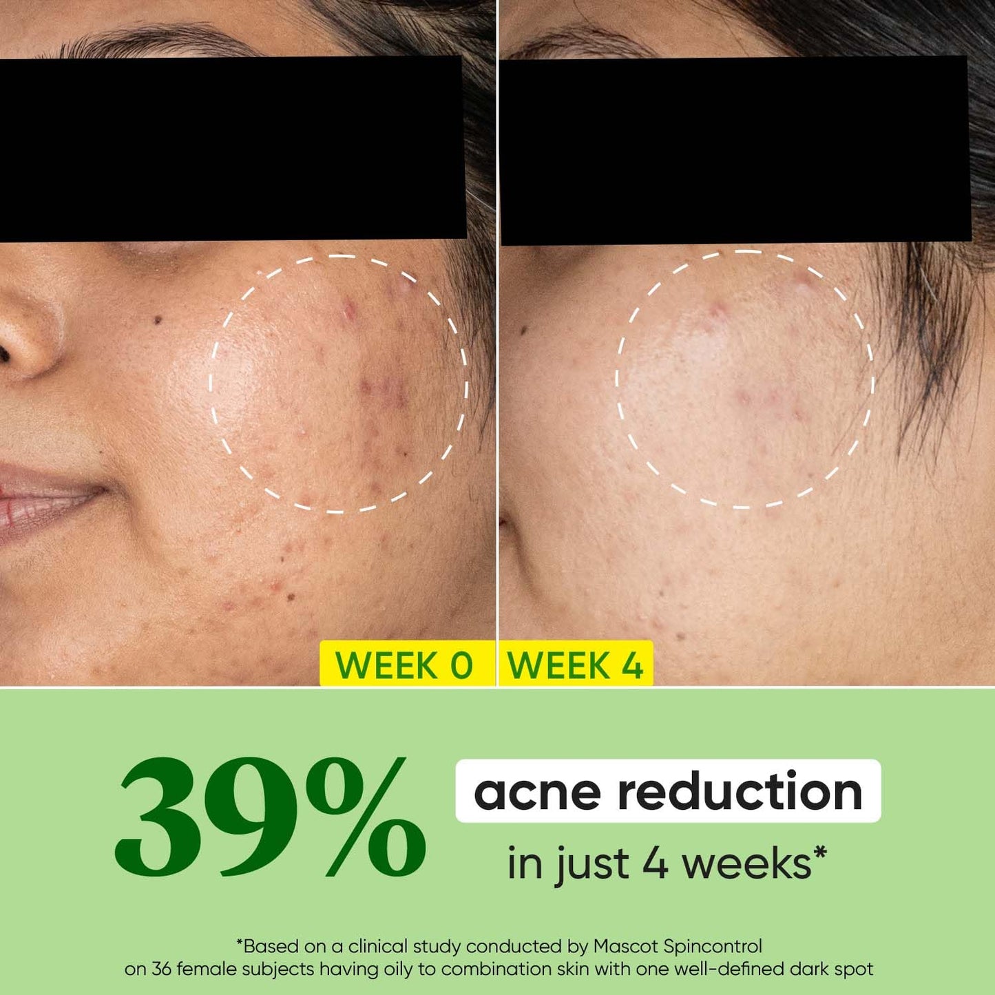 Zephivo Dot & Key CICA Calming Skin Renewing Night Gel | For Oily, Acne Prone And Sensitive Skin | Night Cream with Niacinamide, Green Tea & Hyaluronic | Fades Blemishes & Dark Spots | 60ml