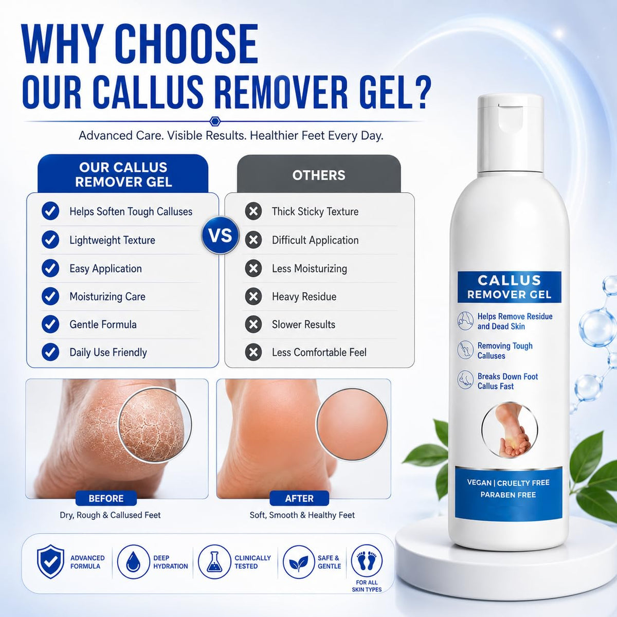 Callus Remover Gel for Feet, Softening and Exfoliating Formula, Dry Rough Skin Care, 200ml, for Men and Women