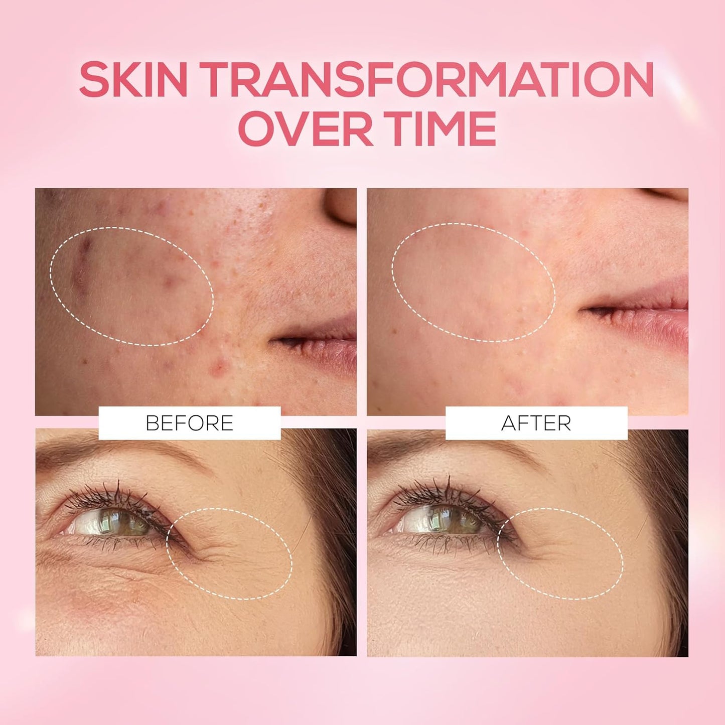 Before and after comparison of skin transformation on a pink background