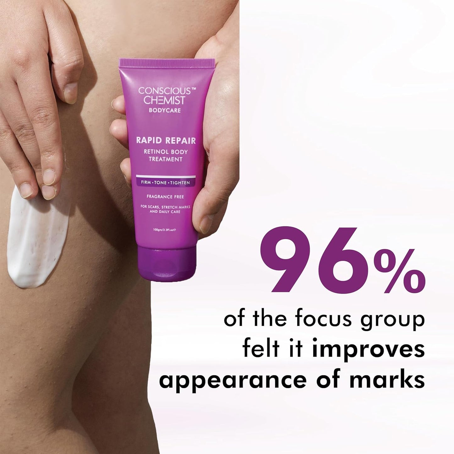 Conscious Chemist® Retinol Body Cream | Reduces Stretch Marks, Uneven Skin Tone & Scars | For Post Pregnancy Irregular Lines/Streaks | All Skin Types, Fragrance Free & Cruelty Free | 100 g