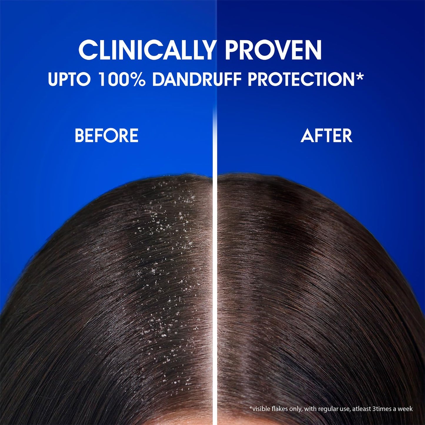 Head & Shoulders Smooth and Silky, Anti Dandruff Shampoo for Women & Men , 1 L
