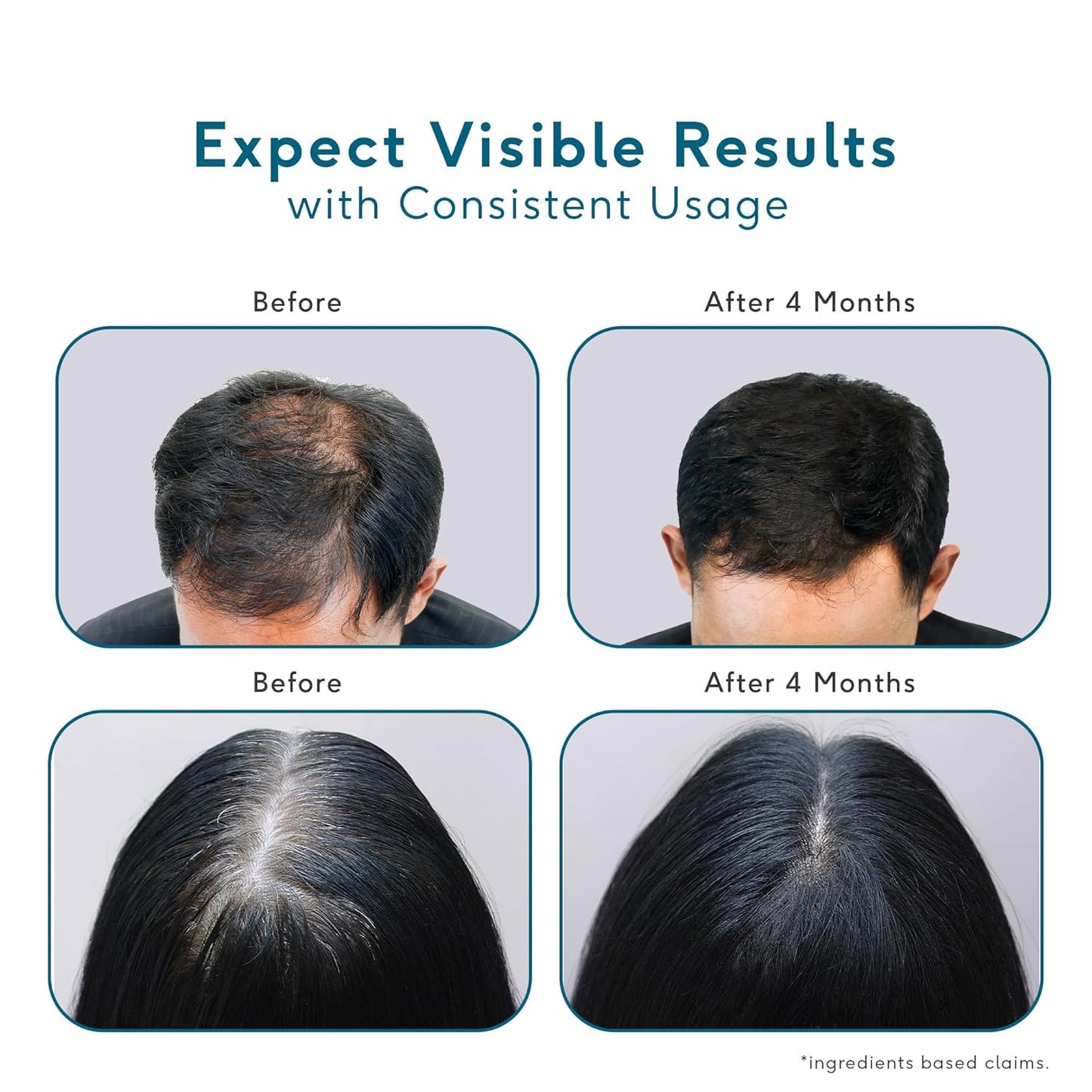 HealthKart HK Vitals Headful Growth Serum with 3% Redensyl, 2% AnaGain, & 2% Cressatine (30ml) | For Hair Growth & Strong Hair | Dermatologically Tested