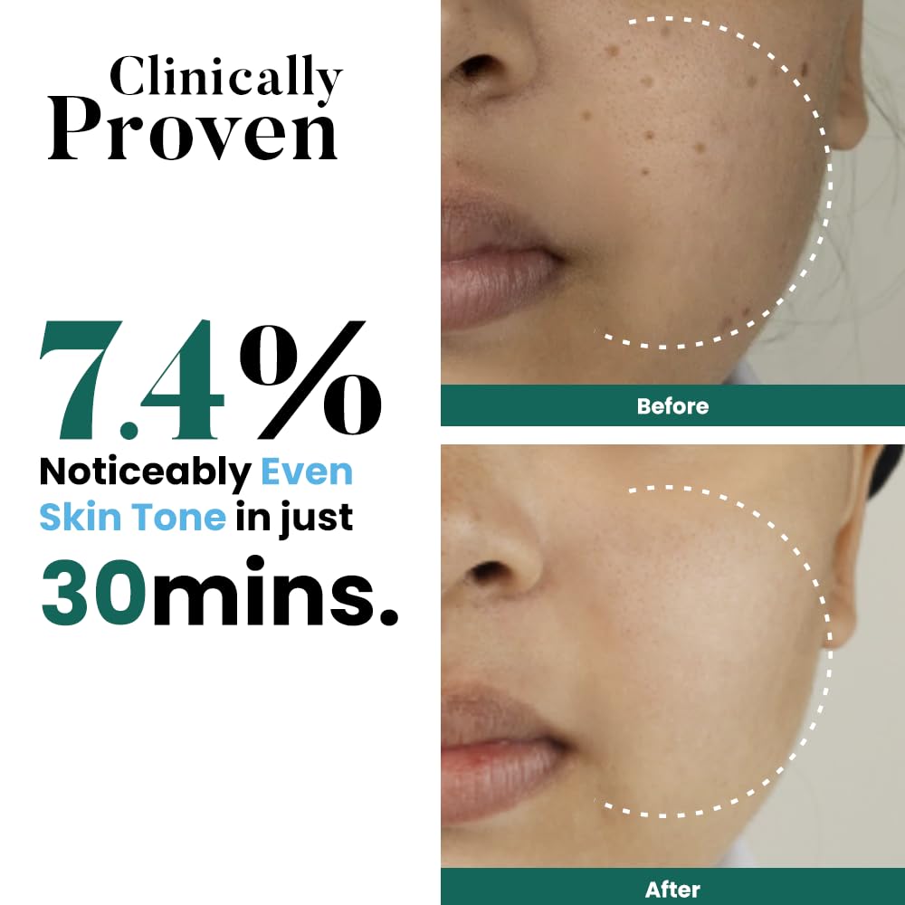 Before and after comparison of skin tone improvement with text indicating clinical proven results.