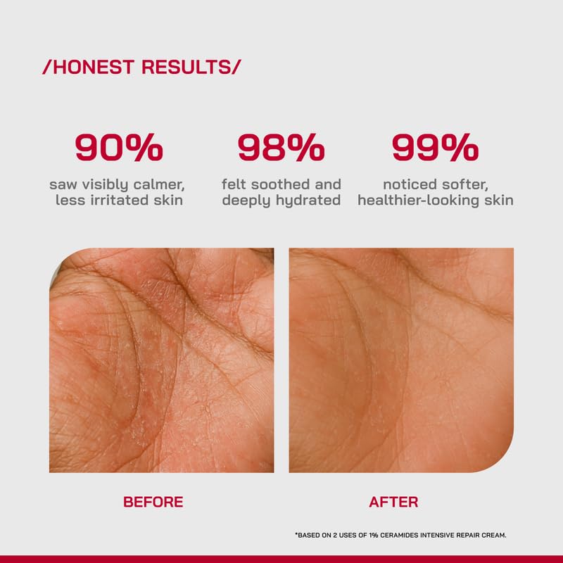 /PHD/ 1% Ceramides Intensive Repair Face Cream with 1% Squalane | For Very Dry, Irritated Facial Skin | Repairs Skin Barrier | Fragrance-Free | Deep Hydration & Soothing | 50g