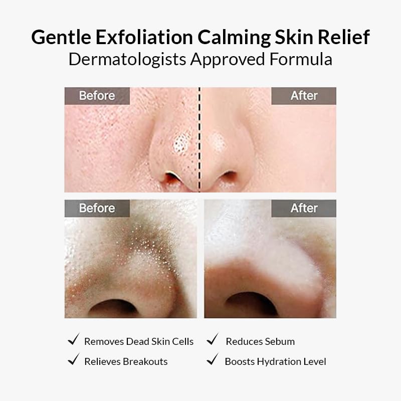 celimax Ji Woo Gae Heartleaf BHA Peeling Pad (60 Pads) Korean Toner Pads with Heartleaf Extract, BHA & Niacinamide, Exfoliating, Pore-Clearing, Removes Dead Skin, Minimises Pores, Calms & Smooths Skin