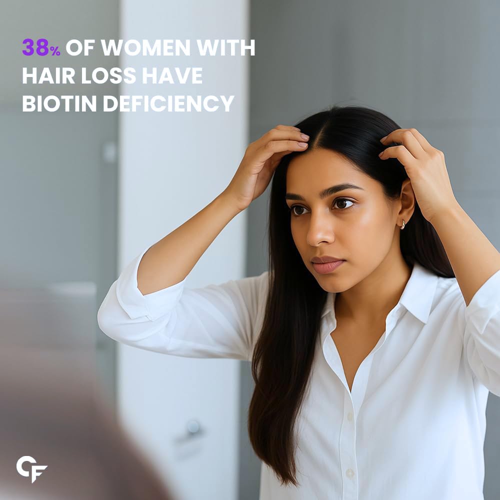 Carbamide Forte Biotin Tablets for Hair Growth with Amla, Brahmi & Bamboo Extract | Hair Growth Tablet | Hair Vitamins | Hair Supplements for Women & Men - 90 Veg Tablet