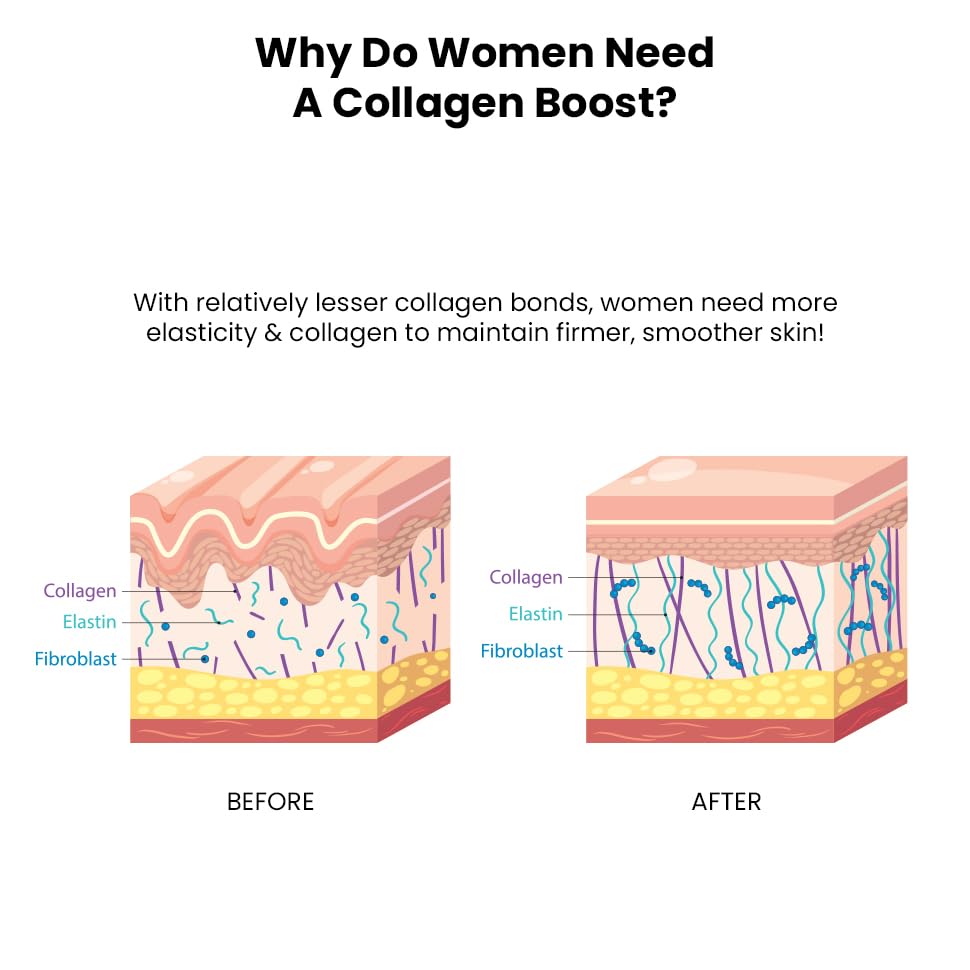 Diagram showing the difference between skin before and after a collagen boost, with labels for collagen, elastin, and fibroblast.