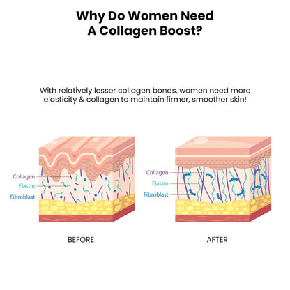 Diagram showing the difference between skin before and after a collagen boost, with labels for collagen, elastin, and fibroblast.