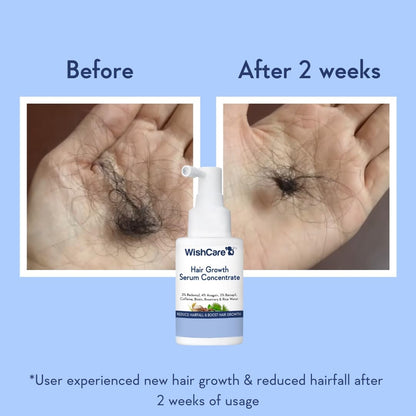 WishCare Hair Growth Serum + Anti Hair Fall Shampoo Combo for Men & Women | Redensyl, Anagain, Baicapil & Biotin | Reduces Hair Fall, Promotes Visible Hair Regrowth | Sulphate Free Shampoo + Leave-In Serum