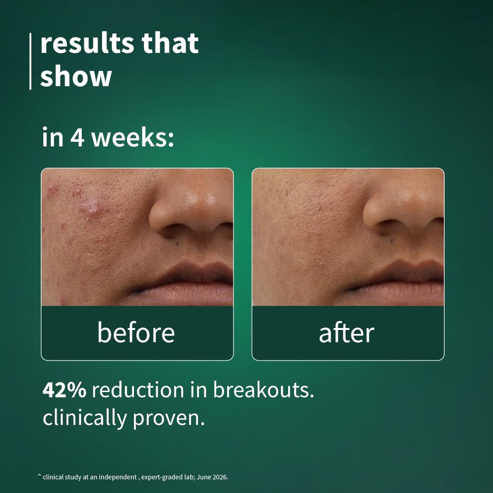 Plum SebaClearTM Mattifying Gel Crème with Matcha & Sebacic Acid | 50g