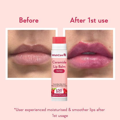 Lip balm packaging with 'Before' and 'After 1st use' comparison of lips on a pink background.