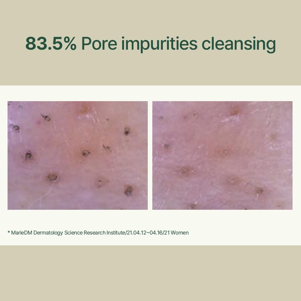 PYUNKANG YUL Calming Low pH Foaming Cleanser - Natural Centella Asiatica Moisturizing Daily Face Wash for Women and Men - Hyaluronic Facial Cleanser for Sensitive Skin - AHA Tea Tree Cica - 5.1 Fl. Oz