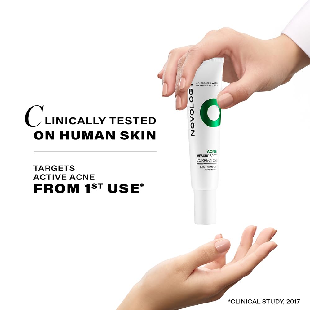 Novolog Acne treatment tube held by a hand with promotional text on a white background