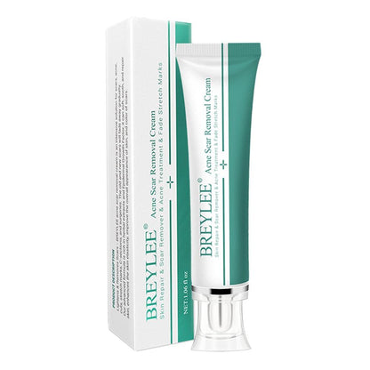 CLUB BOLLYWOOD® Removal Scar Cream Face Pimples Scar Stretch Marks Removal Acne Treatment | Bath & Body | Scar & Stretch Mark Reducers