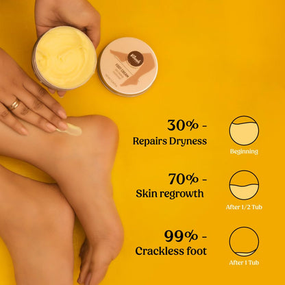 Vilvah Foot Cream for Cracked Heels | Repairs Dry, Rough & Damaged Feet | Softens Calluses & Removes Dead Skin | Deep Hydration & Odour Control | 100ml