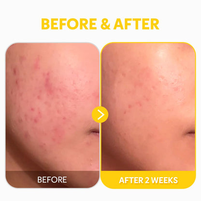TIRTIR Vitamin C 24% Serum for Face, Dark Spot Corrector for Sensitive Skin, Anti Aging Collagen Serum, Even Tone & Wrinkle Care, Korean Skincare - 30ml