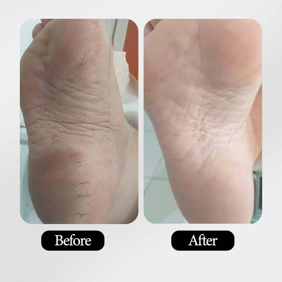 Mitchell USA Anti-aging Foot Cream with Intensive Deep Nourish | Softens and repairs dry & rough feet | With Lotus Seed Extracts & Shea Butter | For Women and Men | 50gms
