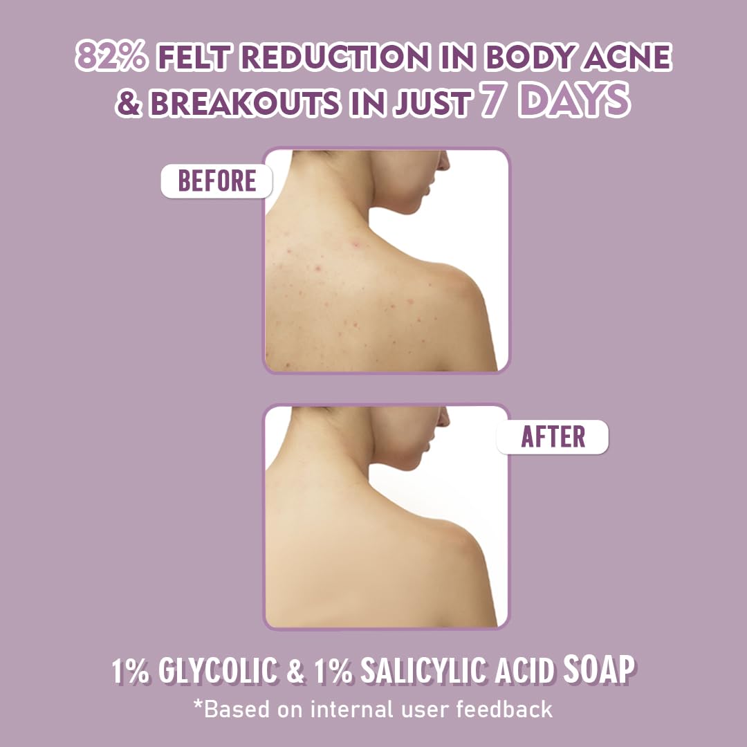 Glamveda Anti Acne 1% ww Glycolic Acid & 1% ww Salicylic Acid Soap | Reduces Dark Spots, Acne Scars & Hyperpigmentation - 75gm Pack of 1