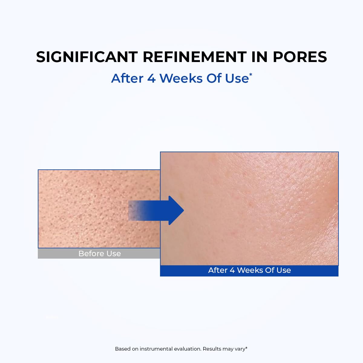 Before and after comparison of skin texture with text indicating significant refinement in pores after 4 weeks of use.