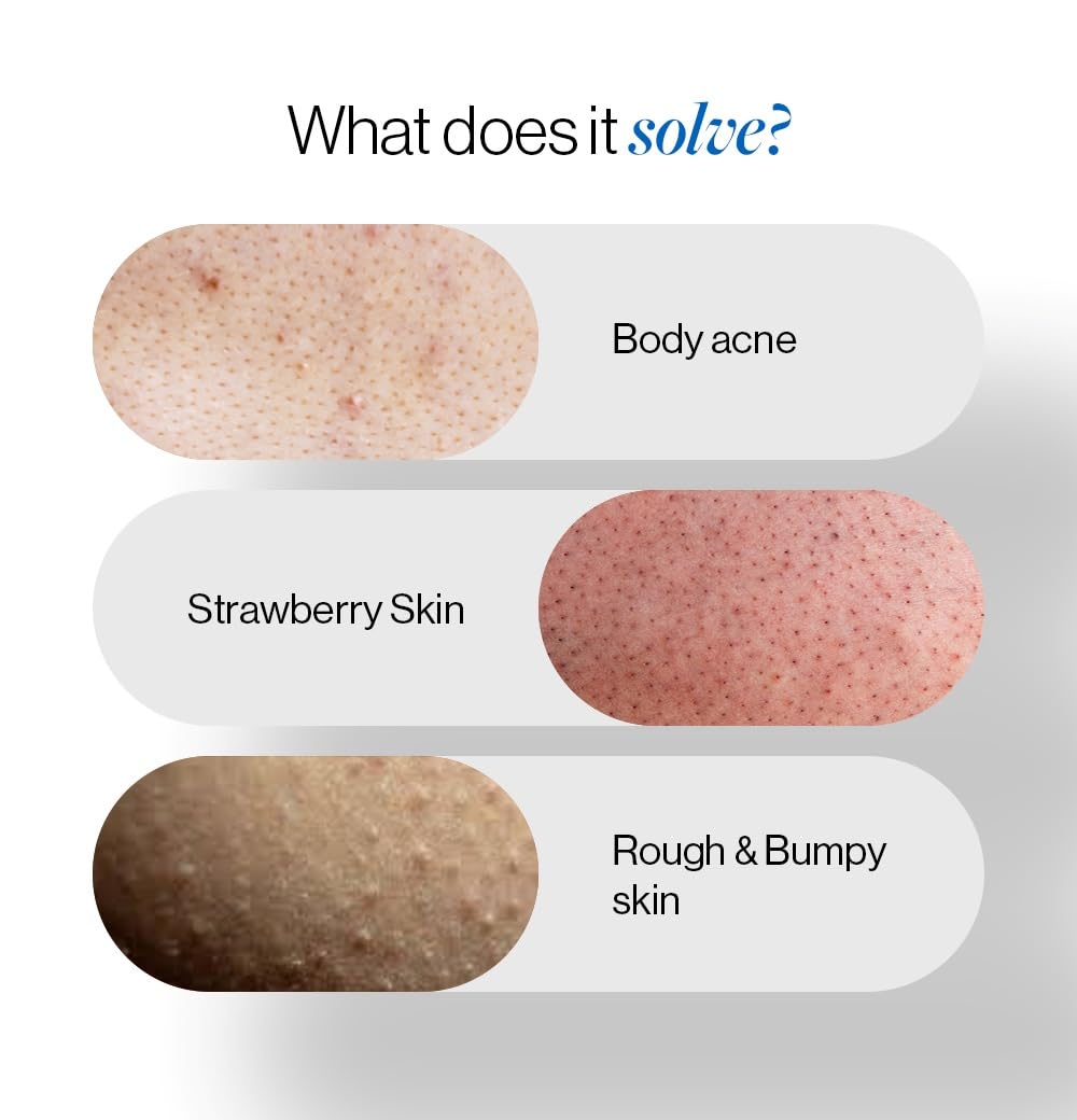 Be Bodywise 1% Salicylic Acid Body Wash | Prevents Body Acne & Exfoliates Skin | With Chamomile Extract | 100ml