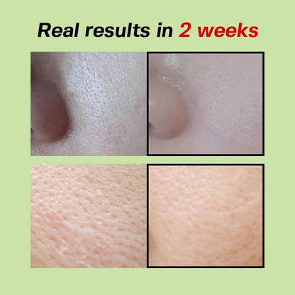 SUNGBOON EDITOR Green Tomato Pore Lifting Ampoule+ (30 ml) | Pore-Tightening & Lifting Serum | Firming, Oil Control & Smoother Skin