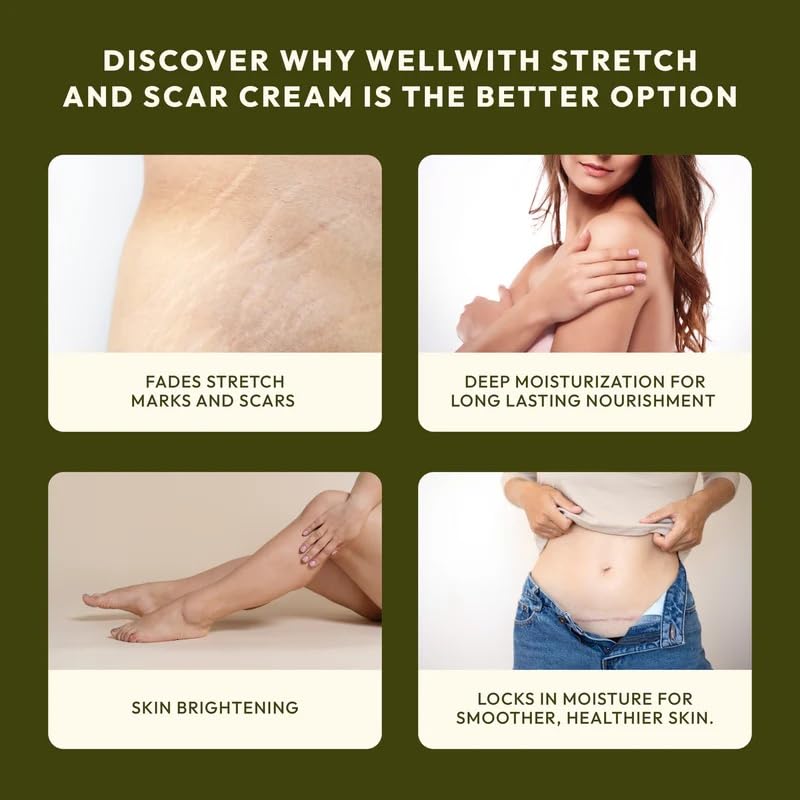 Wellwith Stretch & Scar Cream with Seabuckthorn Oil, Licorice & Hyaluronic Acid, 50g