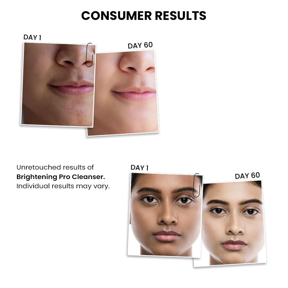 Before and after skin comparison of a cleanser's effect on skin texture and clarity.
