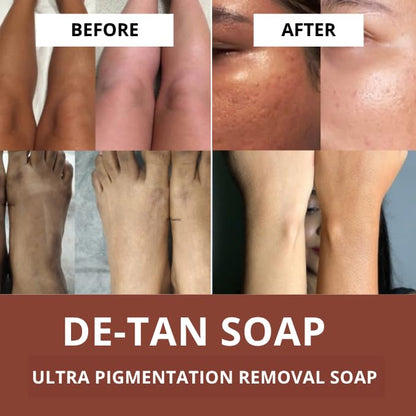 BAKE De-Tan Scrub Treatment Coffee Soap (200Gms Pack of 2) | Ultra Pigmentation Soap for Tan Removal | With 2% Kojic Acid, 1% Glycolic Acid, 1% Alpha Arbutin | | For Pigmentation, Dark Spots & Tan Removal | For Women & Men | 100g x 2