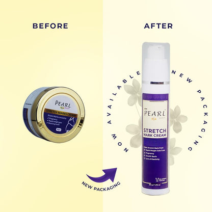 ARM Pearl Beauty Stretch Marks Removal Cream - 50 grms Reduces Stretch Marks & Scars, Hydrates & Enhances Skin Elasticity with Vanistryl, Phyto Bioactives & Glycolift – For Pregnancy, Postpartum, Weight Loss & Muscle Growth