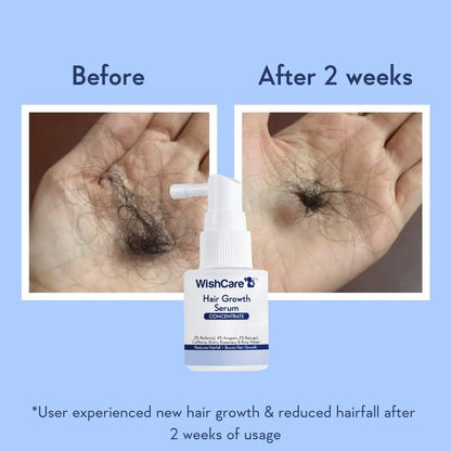 Before and after comparison of hair growth with WishCare Hair Growth Serum on a blue background.