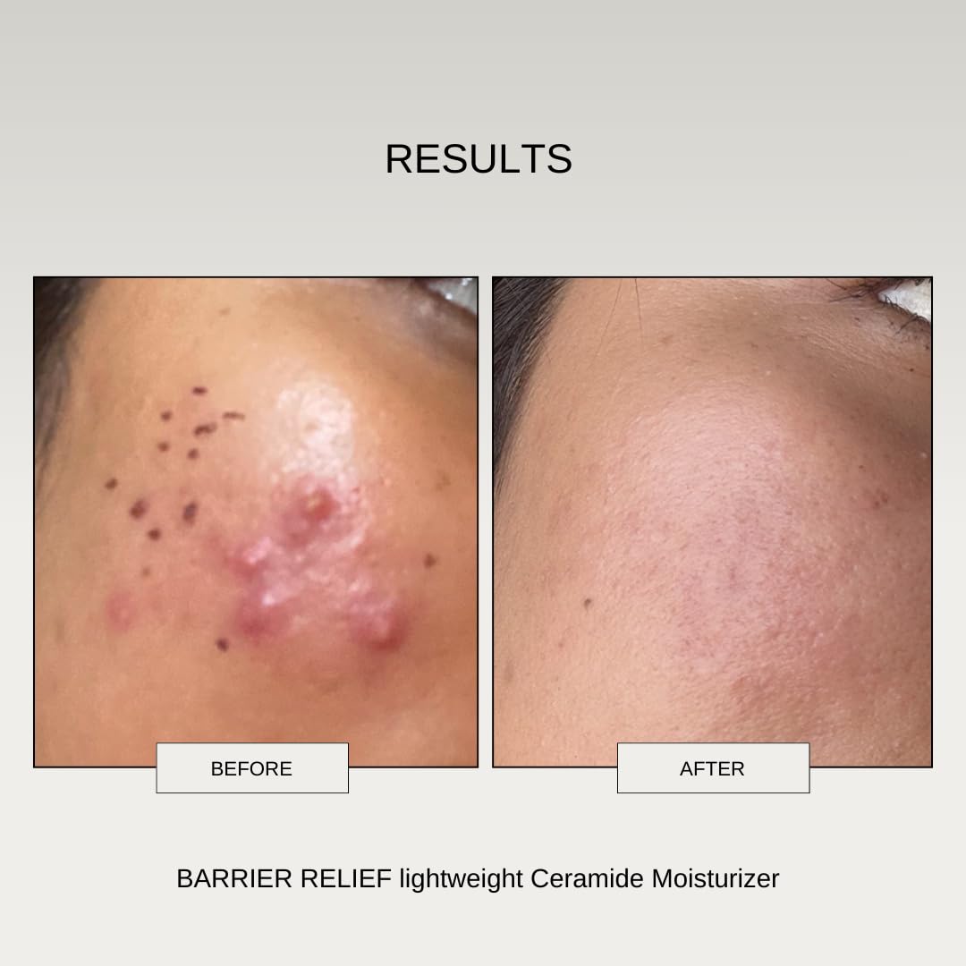 The Formularx Barrier Relief Ceramide Lightweight Moisturizer With Niacinamide & Hyaluronic Acid | For Oily, Combination, Dehydrated, Acne Prone, Sensitive Skin | 50 Gram