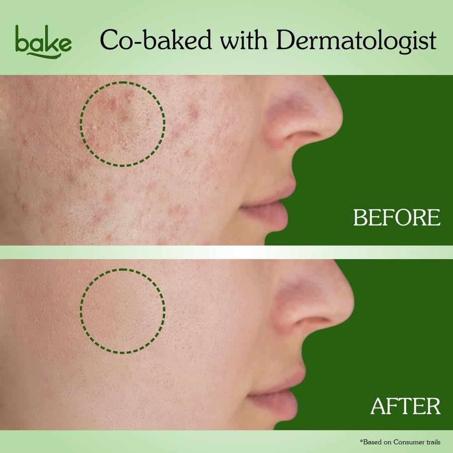 BAKE 2% Salicylic Acid & 3% Niacinamide Face Wash for Oily, Acne-Prone Skin | Treats Active Breakouts & Fades Marks & Dark Spots | Daily Anti-Acne Cleanser - 100ml