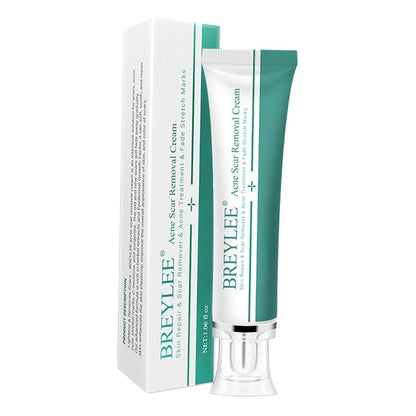 CLUB BOLLYWOOD® Removal Scar Cream Face Pimples Scar Stretch Marks Removal Acne Treatment | Bath & Body | Scar & Stretch Mark Reducers