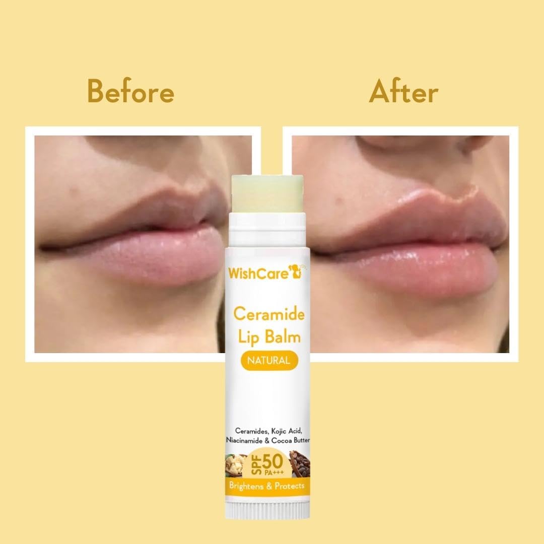 Lip balm packaging with 'Before' and 'After' effect on lips on a yellow background