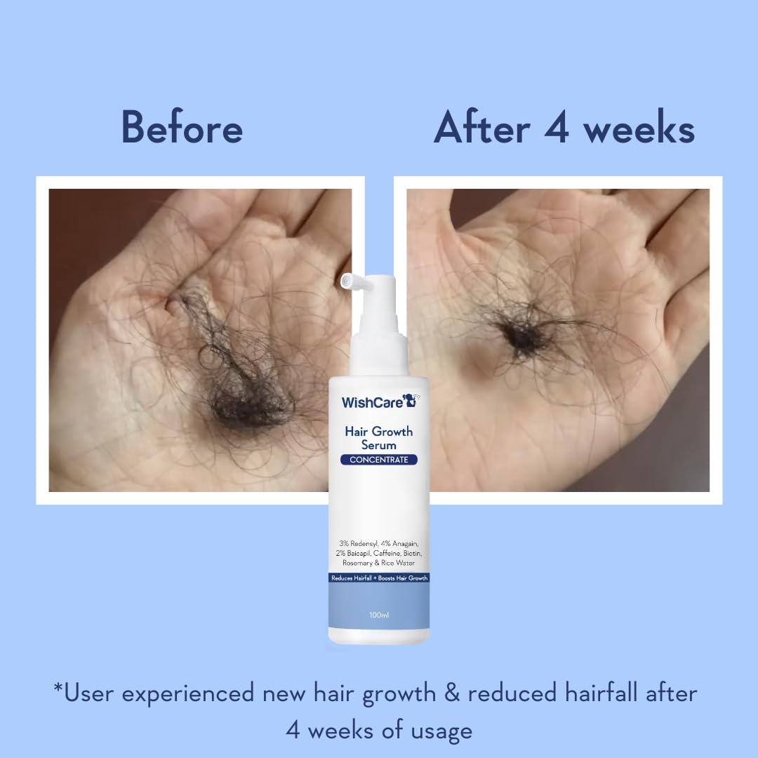 Before and after comparison of hair growth with WishCare Hair Growth Serum on a blue background.