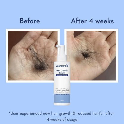 Before and after comparison of hair growth with WishCare Hair Growth Serum on a blue background.