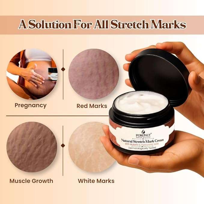 Pokonut Stretch Marks Cream for Women & Men | For Pregnancy, After Delivery & Weight Loss | Fades Old & New Marks on Belly, Thighs & Hips | Hyaluronic Acid + Rosehip Oil | Non-Sticky | 50g