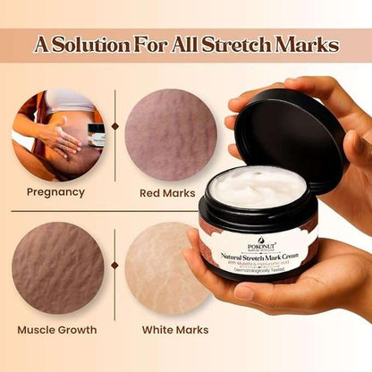 Pokonut Stretch Marks Cream for Women & Men | For Pregnancy, After Delivery & Weight Loss | Fades Old & New Marks on Belly, Thighs & Hips | Hyaluronic Acid + Rosehip Oil | Non-Sticky | 50g