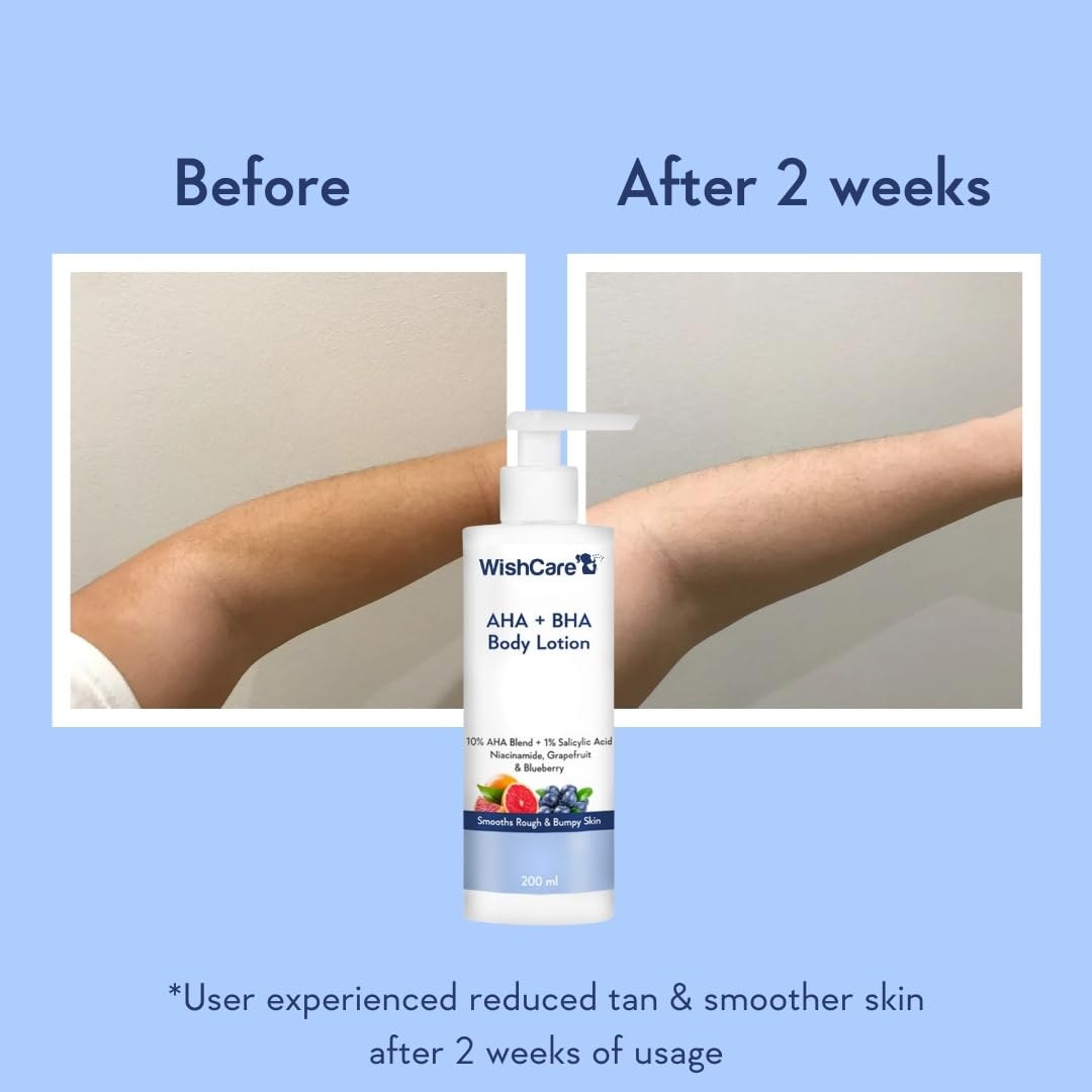 WishCare AHA BHA Body Lotion bottle with 'Before' and 'After 2 weeks' comparison on a blue background