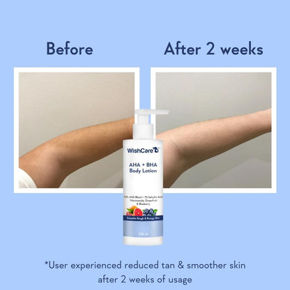 WishCare AHA BHA Body Lotion bottle with 'Before' and 'After 2 weeks' comparison on a blue background