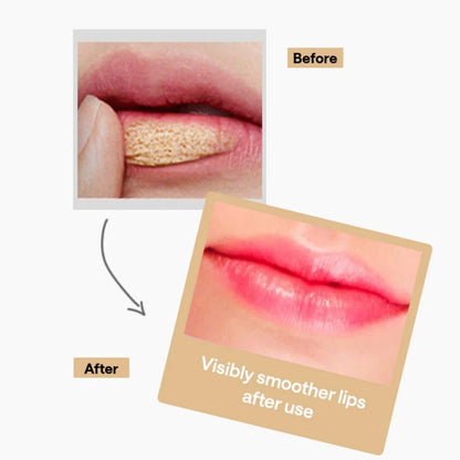 MEDIHEAL Pantenolips Lip Scrub (10ml) Gentle Exfoliating Korean Lip Scrub with Panthenol & Walnut Shell Powder for Dry Flaky Chapped Lips, Smooth Hydrated Lip Care